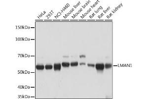 Western blot analysis of extracts of various cell lines, using LM Rabbit mAb (ABIN7268205) at 1:1000 dilution. (LMAN1 anticorps)