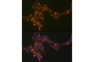 Immunofluorescence analysis of NIH-3T3 cells using ACADM Rabbit mAb (ABIN1678538, ABIN3019056, ABIN3019057 and ABIN7101707) at dilution of 1:100 (40x lens).