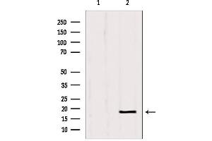 Western blot analysis of extracts from Hela, using SRP14 antibody. (SRP14 anticorps  (Internal Region))