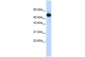 WB Suggested Anti-PATZ1 Antibody Titration:  0. (PATZ1 anticorps  (Middle Region))