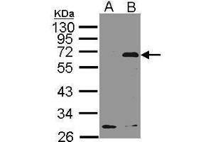 WB Image Western Blot analysis of NET1 expression in transfected 293T cell line by NET1 polyclonal antibody. (NET1 anticorps  (C-Term))
