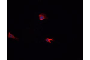 ABIN6269006 staining A-431 cells by IF/ICC.