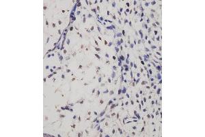 (ABIN6244107 and ABIN6577237) staining SUFU in mouse embryo tissue sections by Immunohistochemistry (IHC-P - paraformaldehyde-fixed, paraffin-embedded sections). (SUFUH anticorps)