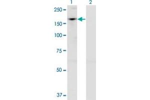 Western Blot analysis of ADNP expression in transfected 293T cell line by ADNP monoclonal antibody (M02), clone 2C5. (ADNP anticorps  (AA 1018-1102))