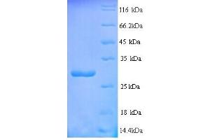 SDS-PAGE (SDS) image for Receptor (TNFRSF)-Interacting serine-threonine Kinase 1 (RIPK1) (AA 1-257), (full length) protein (His tag) (ABIN5713982)