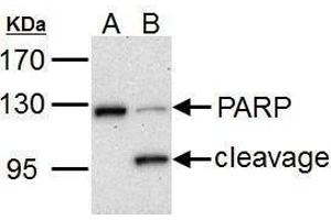 PARP1 anticorps