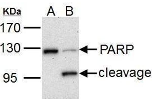 PARP1 anticorps
