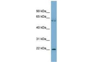 Image no. 1 for anti-Slowmo Homolog 2 (SLMO2) (AA 35-84) antibody (ABIN6742141)