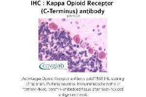 Image no. 1 for anti-Opioid Receptor, kappa 1 (OPRK1) (C-Term) antibody (ABIN1736160) (OPRK1 anticorps  (C-Term))