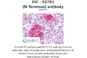 Image no. 1 for anti-Somatostatin Receptor 1 (SSTR1) (Extracellular Domain), (N-Term) antibody (ABIN1739669) (SSTR1 anticorps  (Extracellular Domain, N-Term))