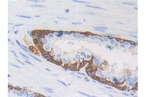 Detection of CYFRA21-1 in Human Prostate Tissue using Polyclonal Antibody to Cytokeratin Fragment Antigen 21-1 (CYFRA21-1)