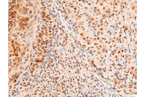 ABIN6267306 at 1/100 staining rat ovarian tissue sections by IHC-P.