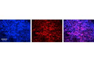 Rabbit Anti-MAX Antibody   Formalin Fixed Paraffin Embedded Tissue: Human Lymph Node Tissue Observed Staining: Nucleus Primary Antibody Concentration: 1:100 Other Working Concentrations: N/A Secondary Antibody: Donkey anti-Rabbit-Cy3 Secondary Antibody Concentration: 1:200 Magnification: 20X Exposure Time: 0.