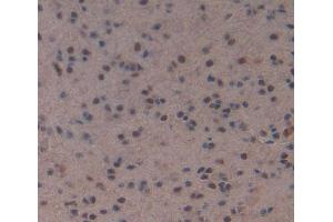Used in DAB staining on fromalin fixed paraffin- embedded Kidney tissue (MEF2A anticorps  (AA 1-160))
