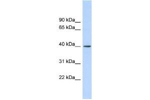 RAD51AP1 antibody used at 1 ug/ml to detect target protein. (RAD51AP1 anticorps  (Middle Region))