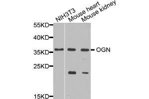 Western blot analysis of extracts of various cell lines, using OGN antibody. (OGN anticorps)
