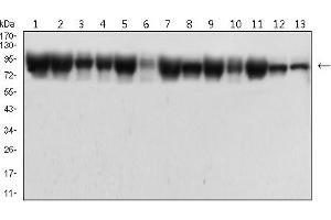Western blot analysis using CTNNB1 mouse mAb against Hela (1), HepG2 (2),NIH3T3 (3),MCF-7 (4), C6 (5),COS-7 (6),K562 (7),Jurkat (8), A549 (9),SH-SY5Y (10),BEL-7402 (11), HEK293 (12), and HEK293-6e (13) cell lysate.