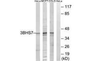 Western blot analysis of extracts from HeLa/MCF-7/COLO cells, using HSD3B7 Antibody. (HSD3B7 anticorps  (AA 121-170))