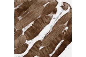 Immunohistochemical staining of human skeletal muscle with MB21D1 polyclonal antibody  shows strong cytoplasmic positivity in myocytes. (C6orf150 anticorps)