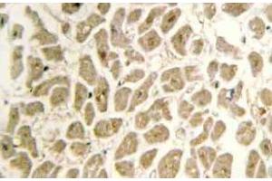 Immunohistochemistry (IHC) analyzes of Siah-2 antibody in paraffin-embedded human heart tissue. (SIAH2 anticorps)