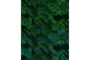 Immunofluorescence analysis of C6 cells using HAL Polyclonal Antibody (ABIN6130467, ABIN6141593, ABIN6141594 and ABIN6216851) at dilution of 1:100 (40x lens).