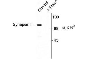 Image no. 1 for anti-Synapsin I (SYN1) (pSer9) antibody (ABIN372718) (SYN1 anticorps  (pSer9))