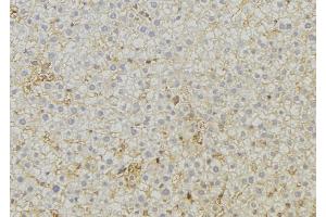 ABIN6279555 at 1/100 staining Mouse liver tissue by IHC-P. (ABCC6 anticorps  (Internal Region))