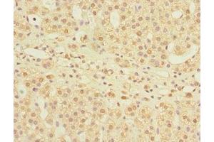 Immunohistochemistry of paraffin-embedded human adrenal gland tissue using ABIN7158982 at dilution of 1:100 (MPI anticorps  (AA 1-423))