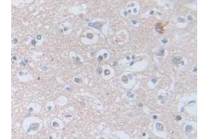 Detection of CAP2 in Human Cerebrum Tissue using Polyclonal Antibody to Adenylyl Cyclase Associated Protein 2 (CAP2)