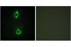 Immunofluorescence (IF) image for anti-phosphoinositide Kinase, FYVE Finger Containing (PIKFYVE) (AA 71-120) antibody (ABIN2889821)