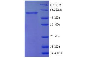 SDS-PAGE (SDS) image for N-Acetylglucosamine Kinase (NAGK) (AA 2-344) protein (His-SUMO Tag) (ABIN5711907)