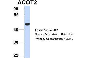 Host: Rabbit Target Name: ACOT2 Sample Type: Human Fetal Liver Antibody Dilution: 1. (ACOT2 anticorps  (Middle Region))