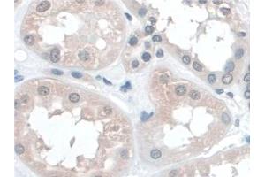 Detection of BANF1 in Human Kidney Tissue using Polyclonal Antibody to Barrier To Autointegration Factor 1 (BANF1)