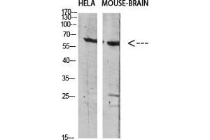 Western Blotting (WB) image for anti-GABA Transporter 1 (GAT1) antibody (ABIN5956621) (SLC6A1 anticorps)