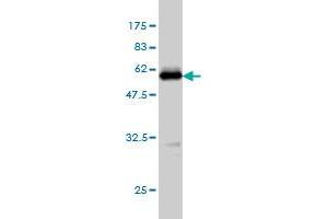 Western Blot detection against Immunogen (52. (TPMT anticorps  (AA 1-245))