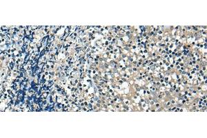 Immunohistochemistry of paraffin-embedded Human tonsil tissue using USP12 Polyclonal Antibody at dilution of 1:35(x200)