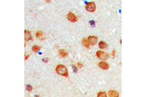 Immunohistochemical analysis of Cytochrome P450 2C19 staining in human brain formalin fixed paraffin embedded tissue section.