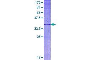 Image no. 1 for Netrin 1 (NTN1) (AA 495-604) protein (GST tag) (ABIN1313112)