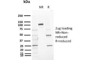 SDS-PAGE Analysis Purified CD72 Mouse Monoclonal Antibody (BU40). (CD72 anticorps)