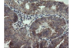 Image no. 2 for anti-ADP-Ribosylation Factor-Like 2 Binding Protein (ARL2BP) antibody (ABIN1496715)