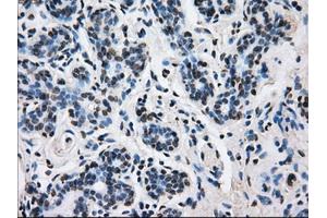 Immunohistochemical staining of paraffin-embedded breast tissue using anti-L1CAM mouse monoclonal antibody. (L1CAM anticorps)