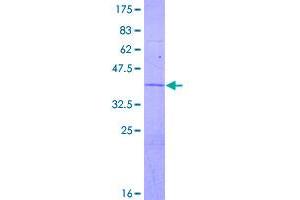 Image no. 1 for ATPase, H+ Transporting, Lysosomal 13kDa, V1 Subunit G2 (ATP6V1G2) (AA 1-118) protein (GST tag) (ABIN1346145)