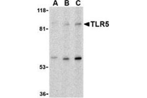 Western blot analysis of TLR5 in THP-1 cell lysate with this product at (A) 0. (TLR5 anticorps  (C-Term))
