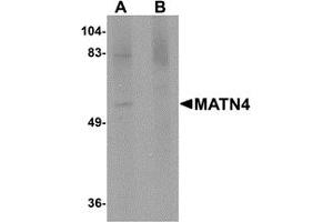 Western Blotting (WB) image for anti-Matrilin 4 (MATN4) (N-Term) antibody (ABIN1031453)