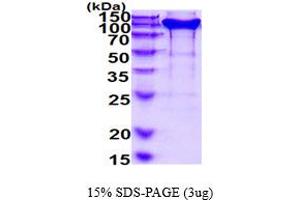SDS-PAGE (SDS) image for Neuropilin 1 (NRP1) (AA 22-855) protein (His tag) (ABIN7529325)