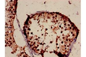 Immunohistochemistry of paraffin-embedded human testis tissue using ABIN7155434 at dilution of 1:100