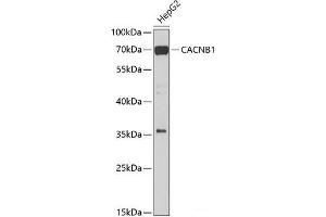 Western blot analysis of extracts of HepG2 cells using CACNB1 Polyclonal Antibody at dilution of 1:1000. (CACNB1 anticorps)