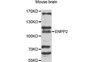 Western blot analysis of extracts of mouse brain, using ENPP2 antibody (ABIN5975354) at 1/1000 dilution. (ENPP2 anticorps)