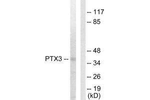Western Blotting (WB) image for anti-Pentraxin 3 (PTX3) (N-Term) antibody (ABIN1849270) (PTX3 anticorps  (N-Term))