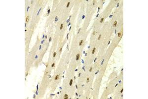Immunohistochemistry of paraffin-embedded Rat heart using KPNA4 antibody at dilution of 1:100 (x400 lens).